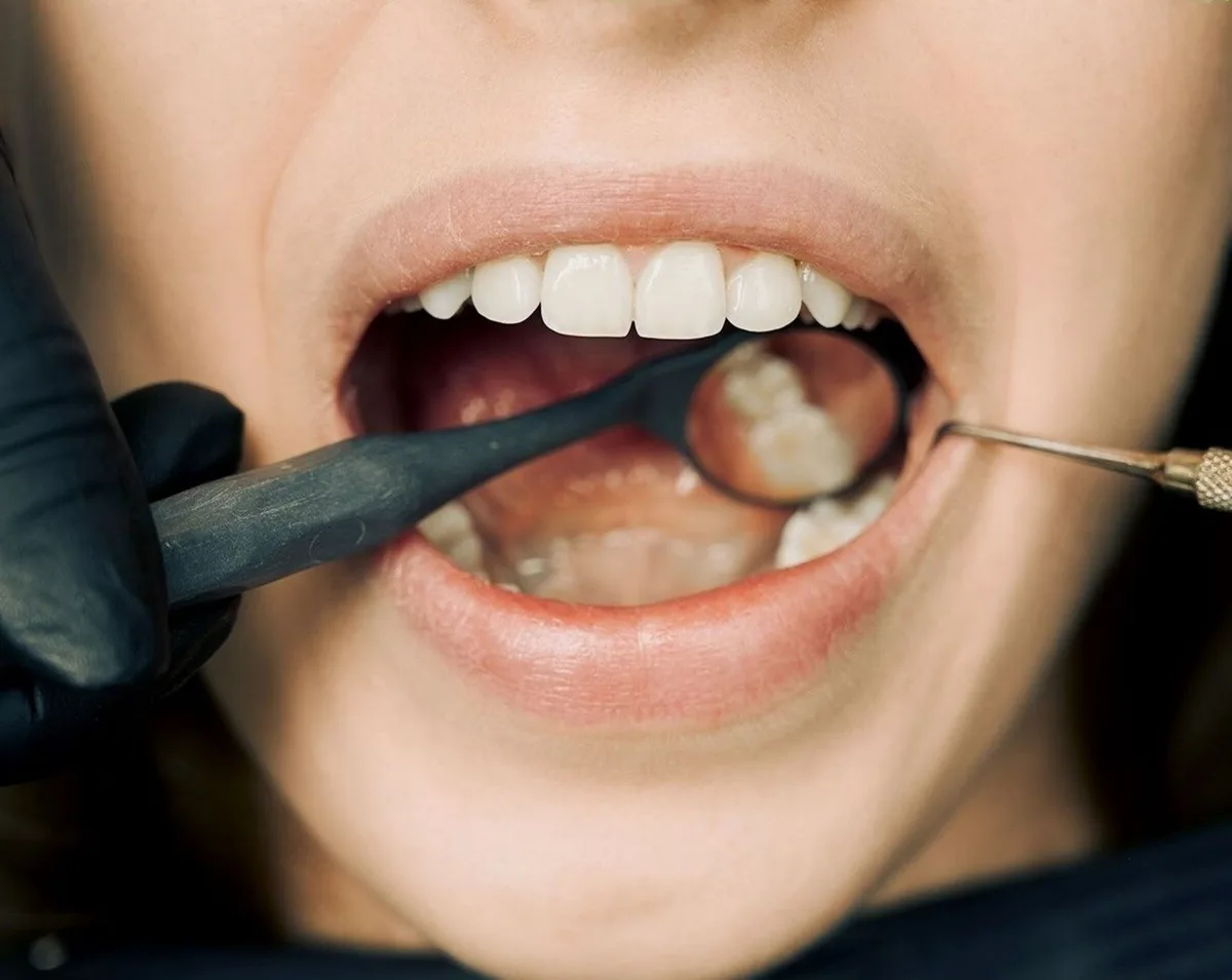 Dental Coverage