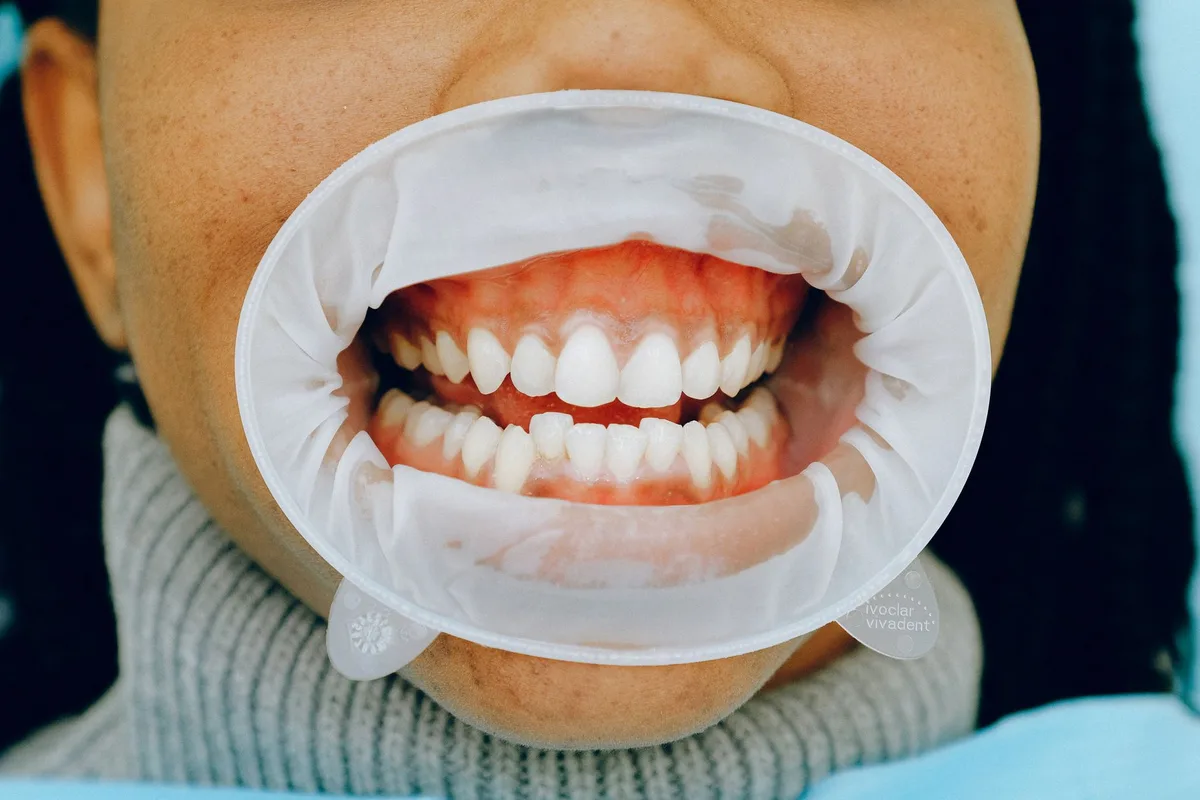 gum health