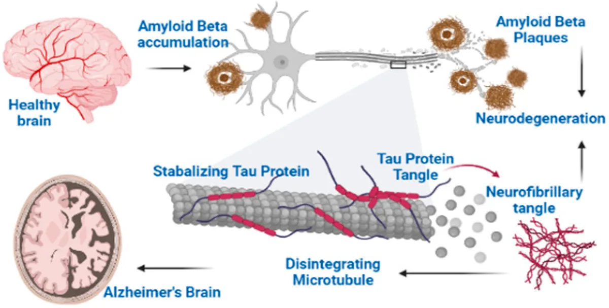amyloid plaque formation in the brain
